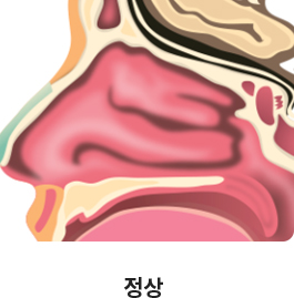 정상 이미지
