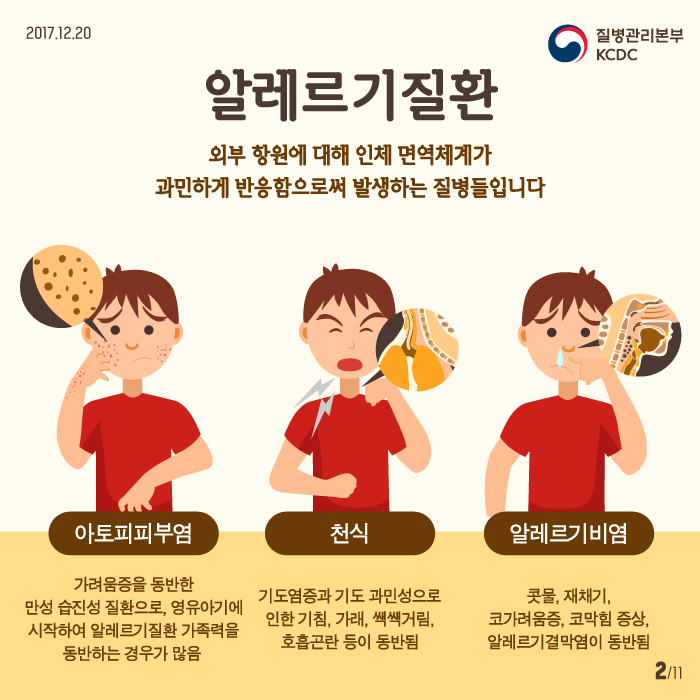 171219_NIH_알레르기 (2).jpg