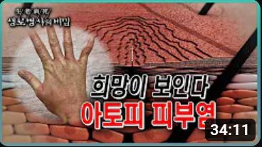 갤러리